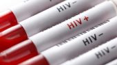 آخرین آمار ایدز در کشور/ تغییر الگوی انتقال بیماری