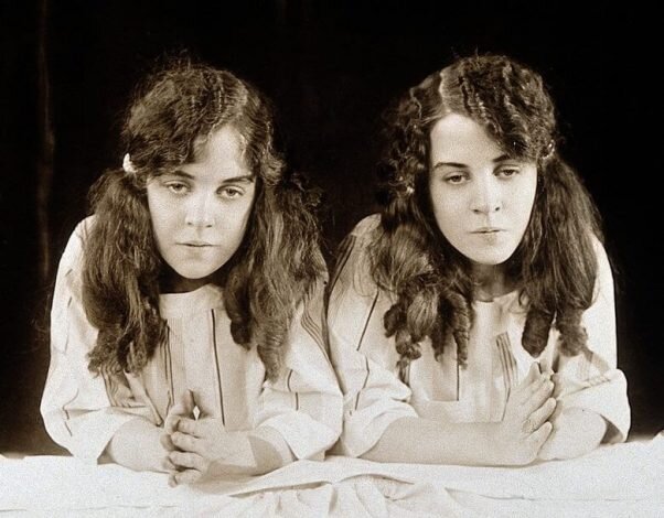 عجیبترین دوقلوهای جهان را بشناسید/ عکس