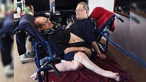 عجیبترین دوقلوهای جهان را بشناسید/ عکس