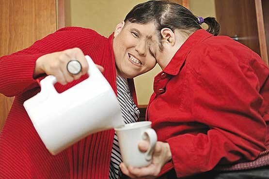 عجیبترین دوقلوهای جهان را بشناسید/ عکس