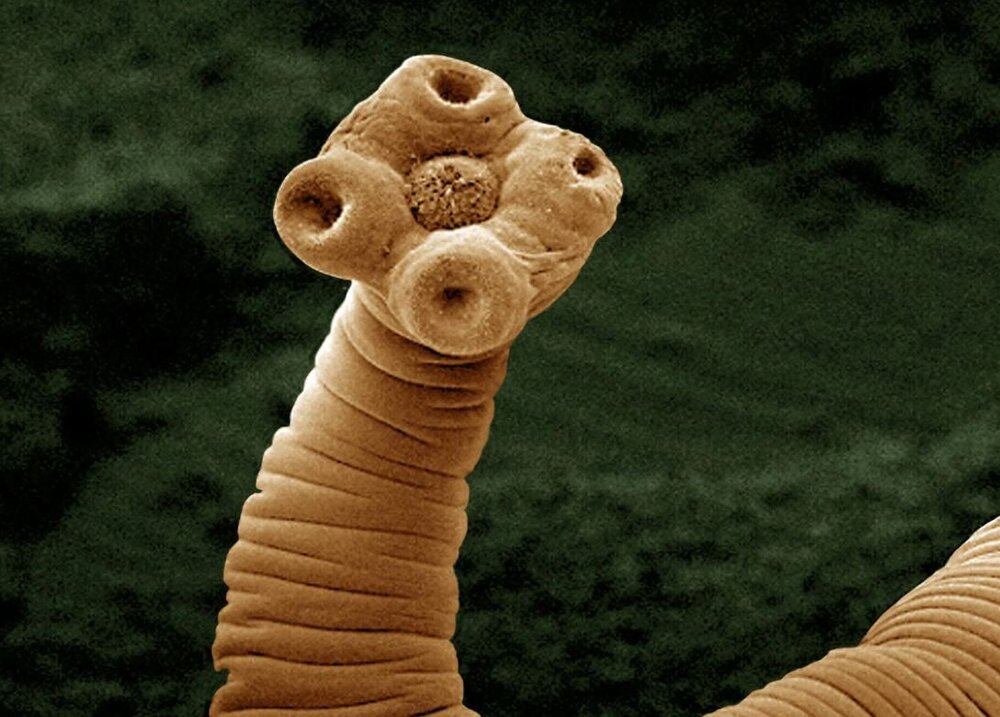 انگلها مسکن میشوند!