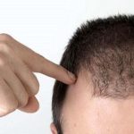 عادت‌های ساده برای جلوگیری از ریزش مو