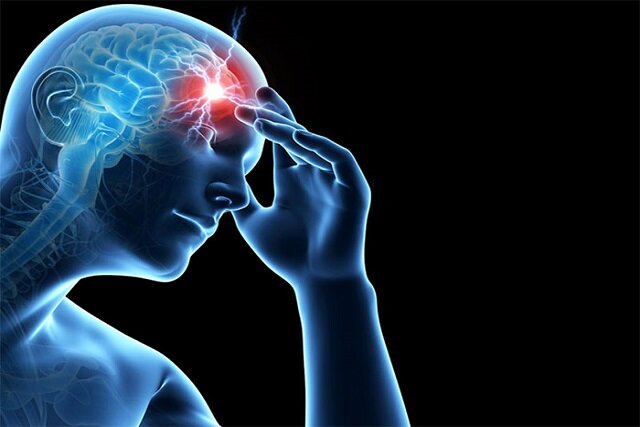 افزایش سکته مغزی در ایران: سن بروز و عوامل خطر