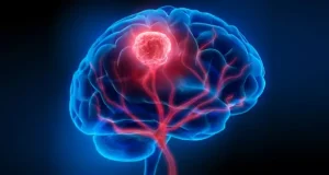 تراشه جدید برای تشخیص تومور مغزی؛ انقلابی در علم پزشکی